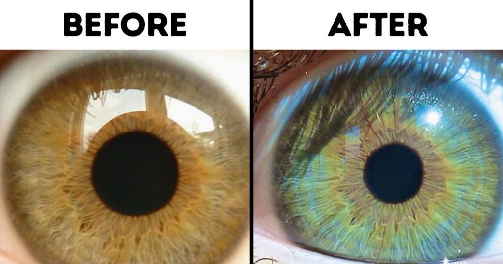 Factors to remember while you decide to change your eye color naturally